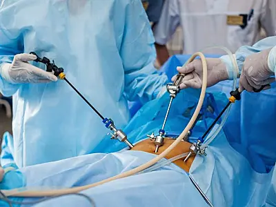 Saúde de MS amplia acesso à cirurgia bariátrica com triagem criteriosa