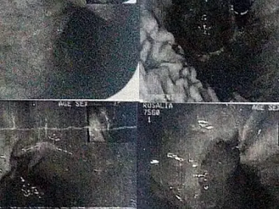 Mulher de Corumbá que teve gaze esquecido dentro do corpo receberá R$ 6,6 mil de indenização
