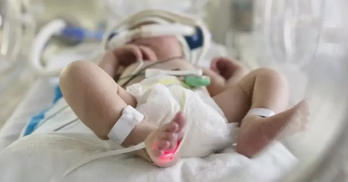 Bebês prematuros com comorbidades poderão receber medicação preventiva a SARS