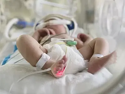 Bebês prematuros com comorbidades poderão receber medicação preventiva a SARS