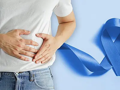 Campanha alerta para prevenção e diagnóstico precoce do câncer de intestino