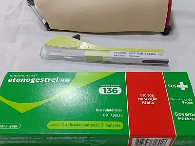 Saiba como acessar DIU e implante subdérmico pelo SUS em MS