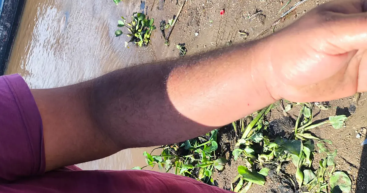 Homem picado por escorpião é resgatado no Pantanal