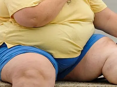 Projeto de Lei prevê implantação de Programa de Enfrentamento da Obesidade Mórbida na Saúde