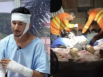 Atacado por onça-pintada deixa hospital e volta para Corumbá