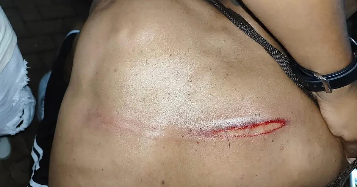 Jovem que apanhou da PM faz corpo de delito nesta tarde