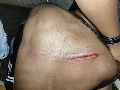 Jovem que apanhou da PM faz corpo de delito nesta tarde