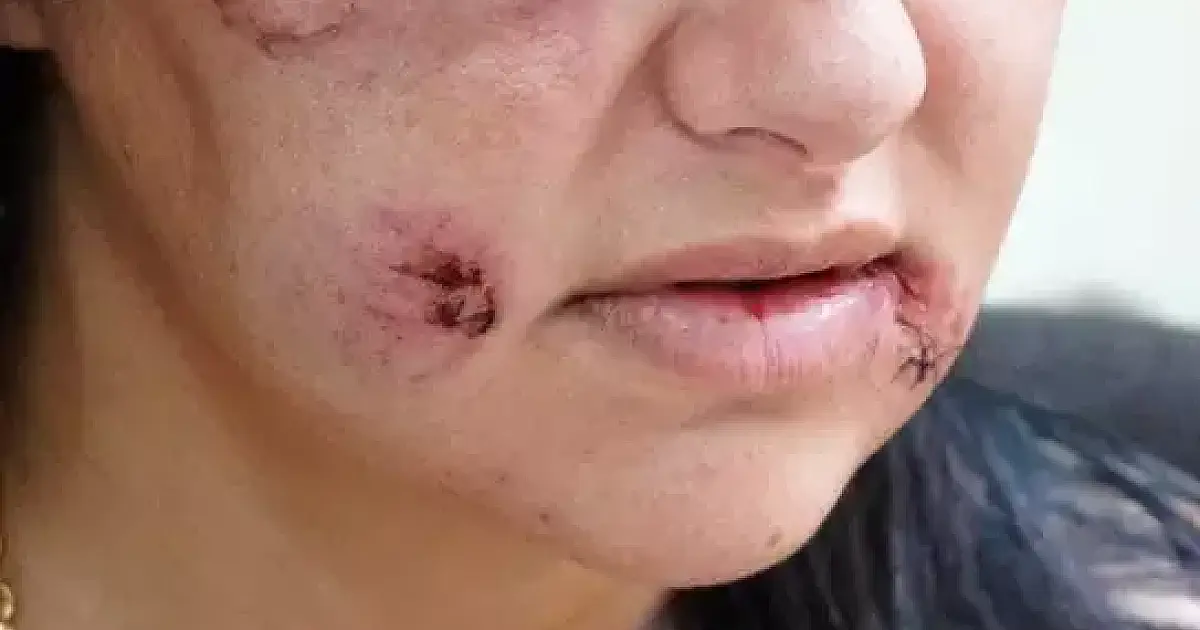 Homicídios caem em MS mas feminicídios e mortes sem solução crescem
