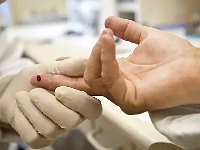 Em mês Dezembro Vermelho, Saúde continua com testagem rápida e distribuição de preservativos