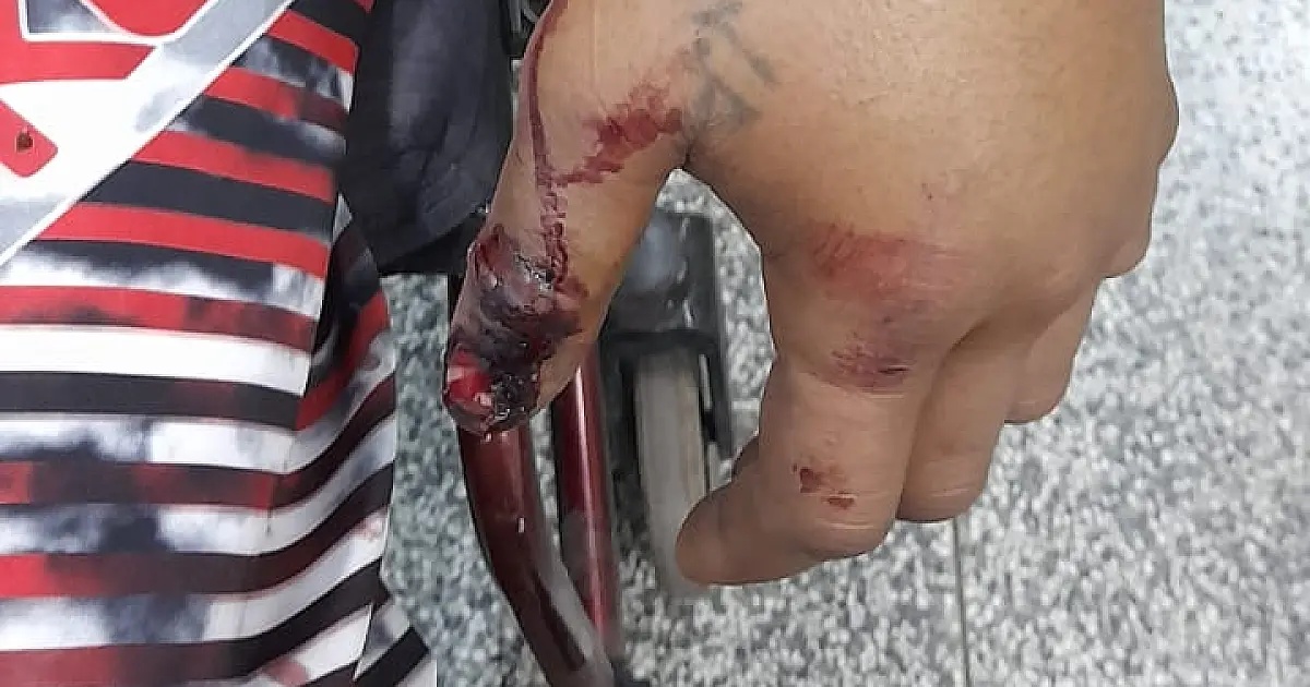 Homem picado por Jararaca é resgatado na região da Nhecolândia