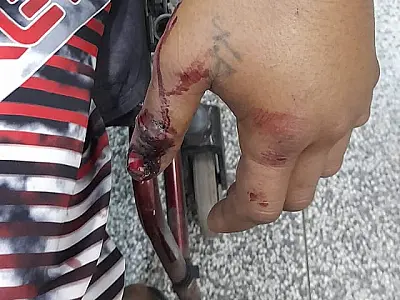Homem picado por Jararaca é resgatado na região da Nhecolândia