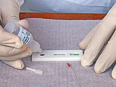 Saúde confirma 1,4 mil novos casos e 18 mortes por Covid no Estado