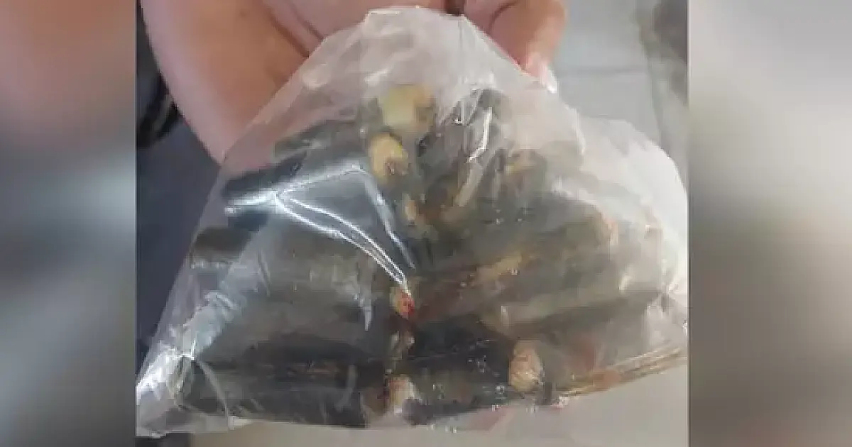 Boliviano passa por cirurgia para retirar 20 cápsulas de cocaína do estômago
