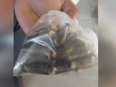 Boliviano passa por cirurgia para retirar 20 cápsulas de cocaína do estômago