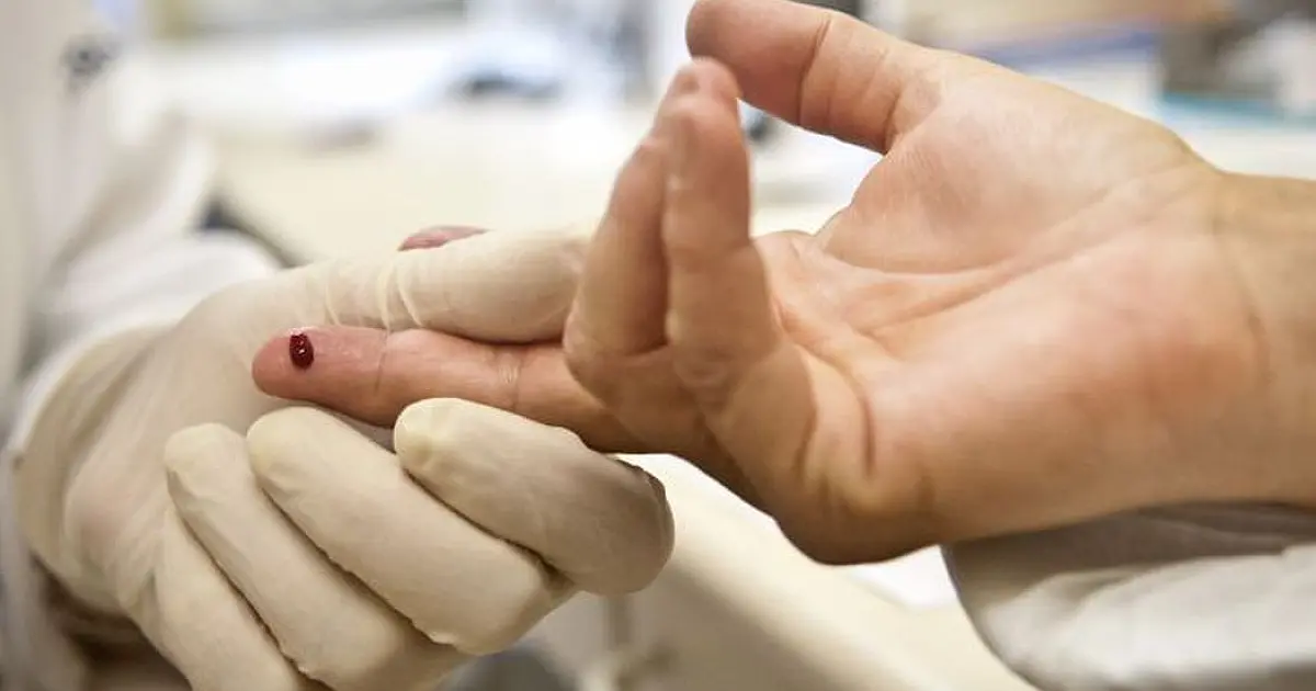 Paciente é declarado curado do HIV após receber células-tronco