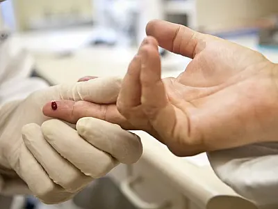Paciente é declarado curado do HIV após receber células-tronco