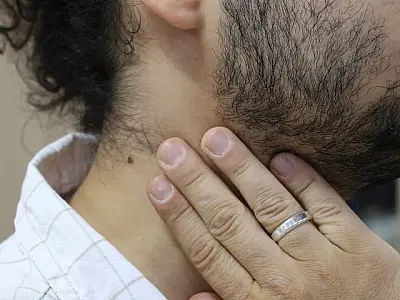Saúde de MS reforça ações de prevenção e diagnóstico precoce do Câncer de Cabeça e Pescoço