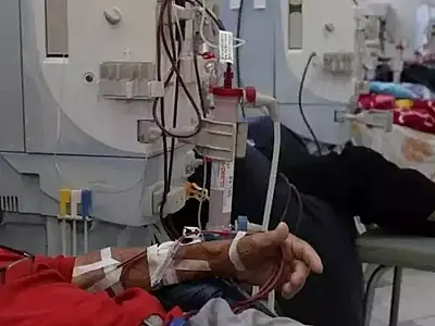 Estudo aponta que doença renal triplica risco de morte por dengue