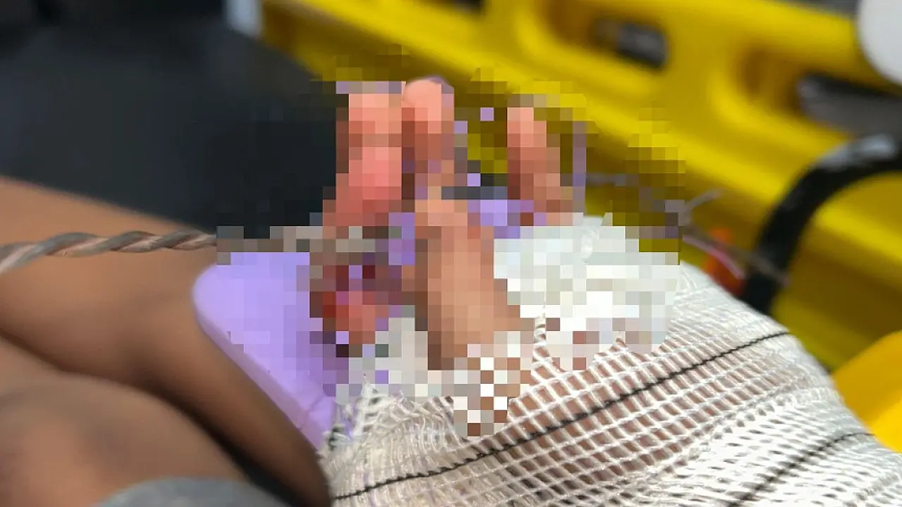 Criança prende a mão em arame farpado durante brincadeira em Ladário